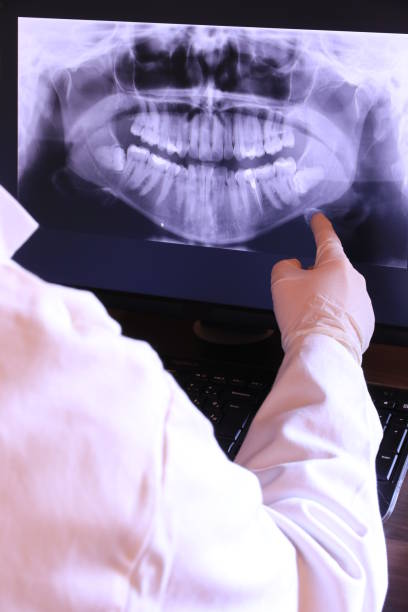 Best Emergency Treatment for Dental Infections or Abscesses in Ridgewood, NJ