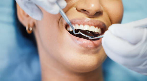 Best Urgent Care for Lost Fillings or Crowns in Ridgewood, NJ